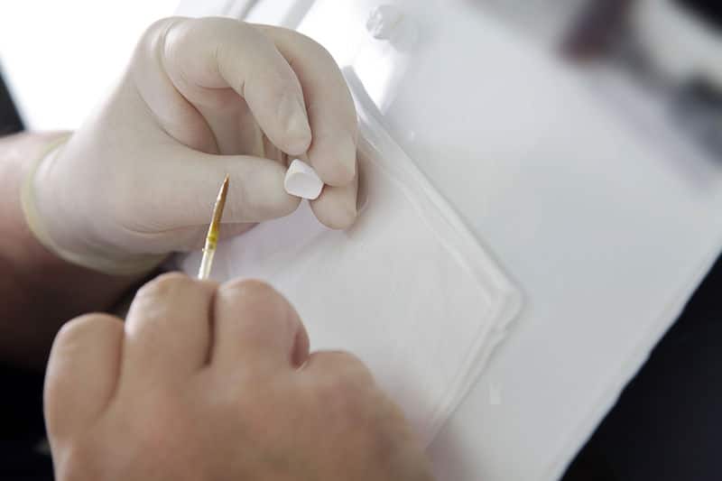 כתר זירקוניה לשיניים זירקוניה לשיניים