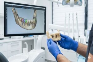 תכנון דיגיטלי והדמיה של כתרים על שתלים